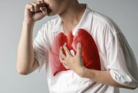 Cara Menemukan Terapis Yang Tepat